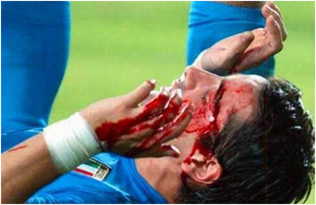 2002年世界杯韩国黑哨——意大利球员被逼抢的头破血流